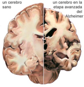 cerebro